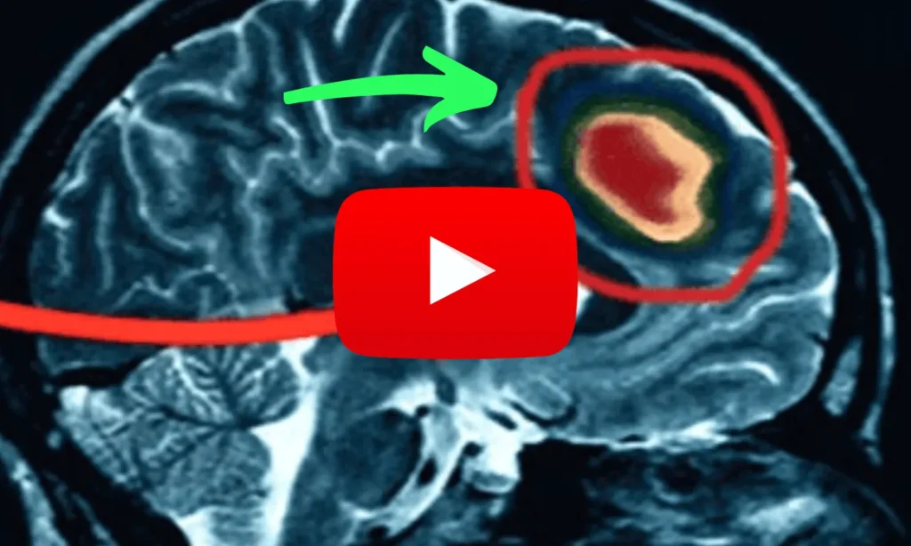 tinnitus presentation